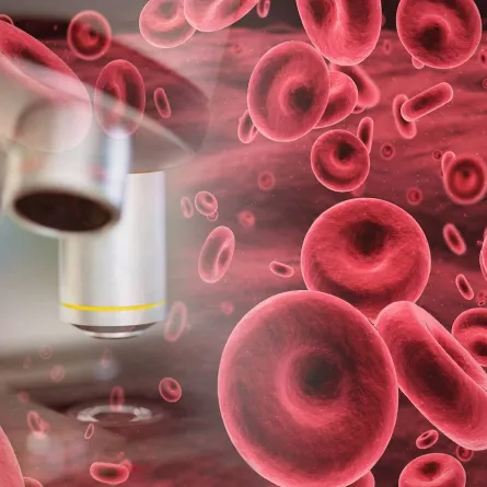 أعراض ارتفاع كريات الدم الحمراء