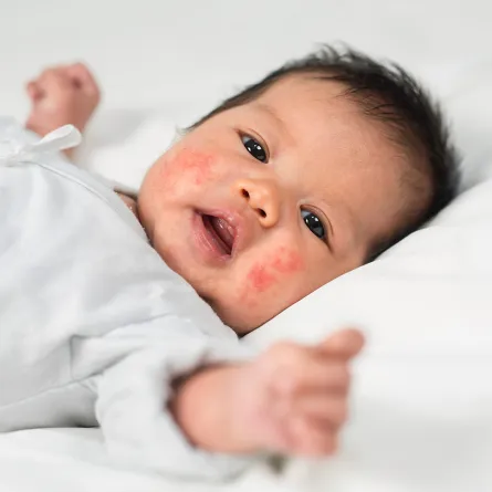 كل ما تريدين معرفته عن الحساسية داخل المنزل عند الأطفال