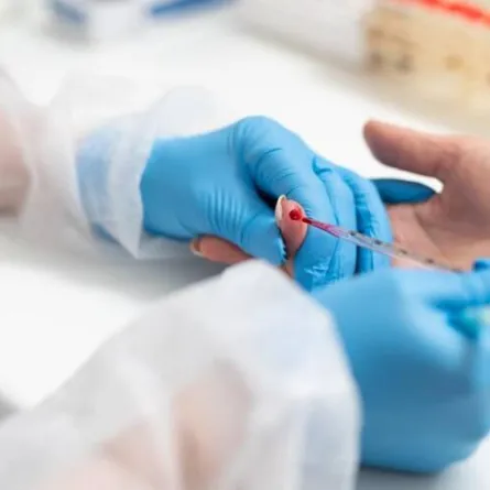 علاج جديد للأمراض عبر فصادة الدم.. طبيبة إماراتية تتحدث