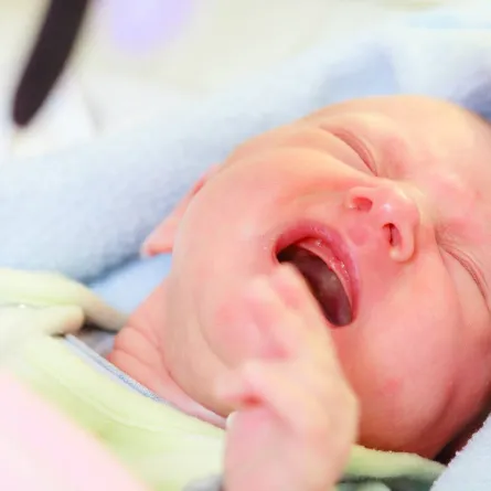 صورة للمغص عند الرضع