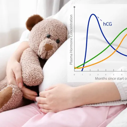 صورة للحامل