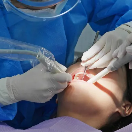 صورة لعلاج الأسنان