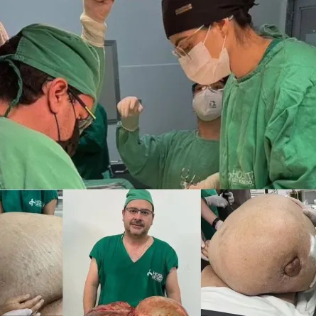  ورم وزنه 45 كلغ 