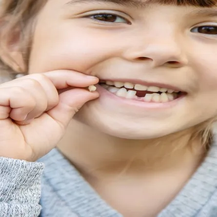 صورة لطفلة تحمل سن سقط من فمها