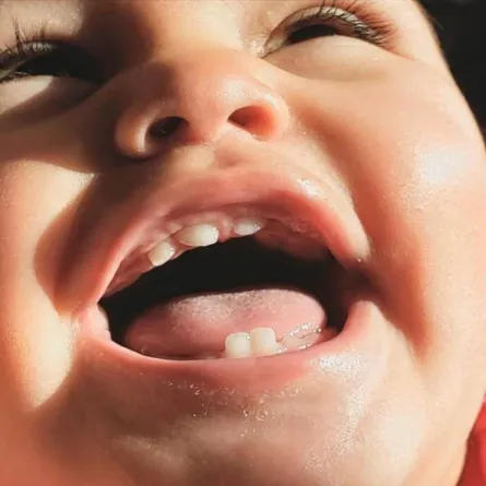 صورة لرضيع بدأت أسنانه بالظهور