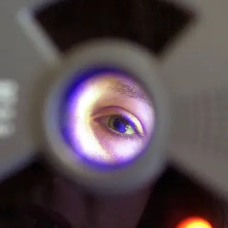 صورة لفحص العين عن طريق الذكاء الاصطناعي