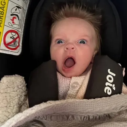 أم تتفاجأ بشعر طفلتها بعد 10 أسابيع من ولادتها