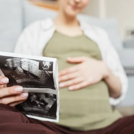 صورة لامرأة حامل تحمل صورة لأشعة الموجات الفوق صوتية