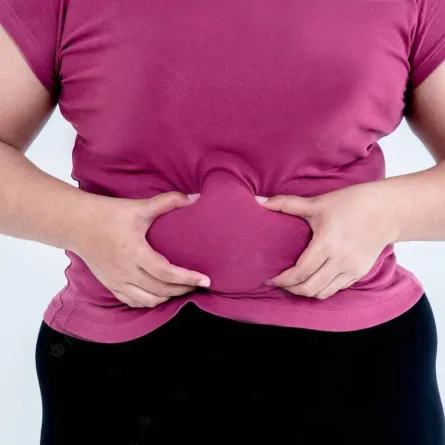 أسباب ظهور البطن السفلية عند النساء وطرق التخلص منه