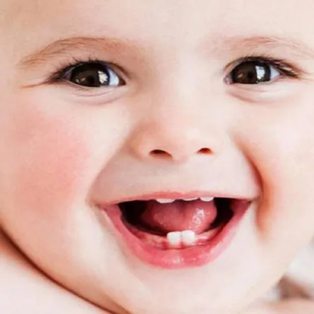 صورة ترمز للتسنين