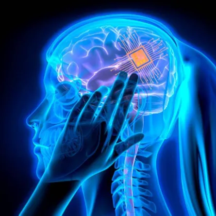 ماسك: يمكن بدء تجارب زرع شرائح بأدمغة البشر خلال 6 أشهر