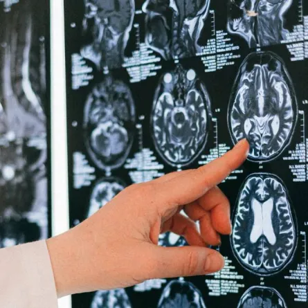 ظهور علامات شيخوخة على المراهقين.. والسبب كورونا