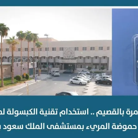 استخدام تقنية الكبسولة لمراقبة درجة حموضة المريء بمستشفى الملك سعود بعنيزة