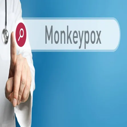 صورة لطبيب يقوم بتشخيص جدري القرود