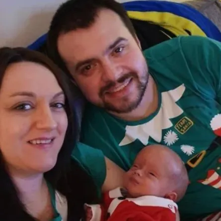 طفل يولد مرتين بسبب حالة نادرة