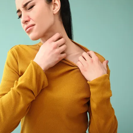 صورة لامراة تعاني من الحكة