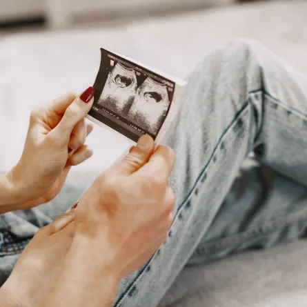 صورة لزوجين يراقبان أشعة الجنين