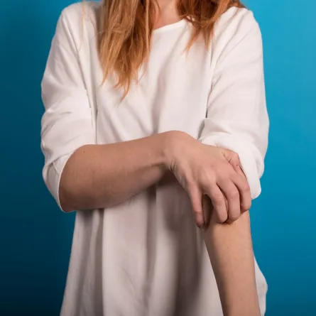 طرق علاج التينيا نهائياً.. هل هي فعّالة؟ (المصدر: Adobe.Stock)