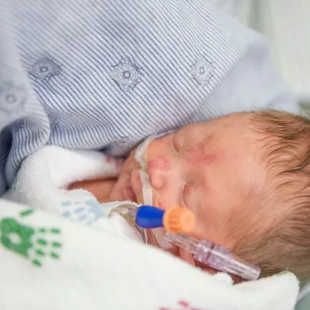 صورة لمولود مبستر