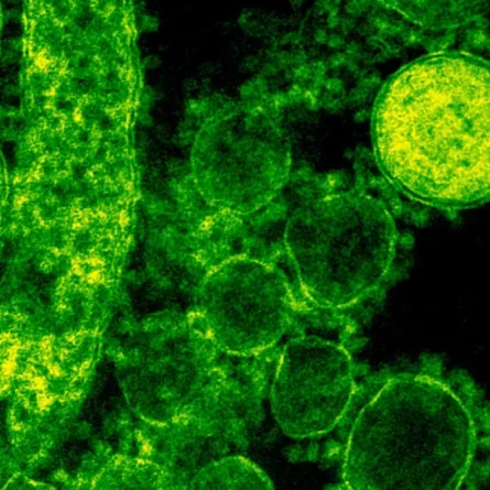 فايروس قاتل- المصدر Pexels