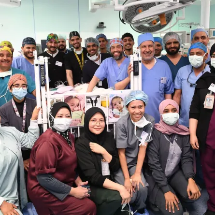 نجاح عملية فصل التوأم السيامي اليمني سلمان وعبدالله