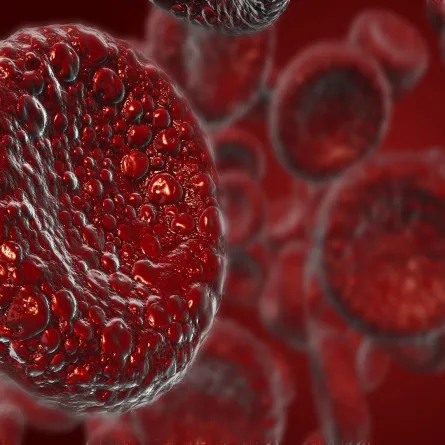 ما هو مرض فقر الدم المنجلي؟ (المصدر: Adobe.Stock)