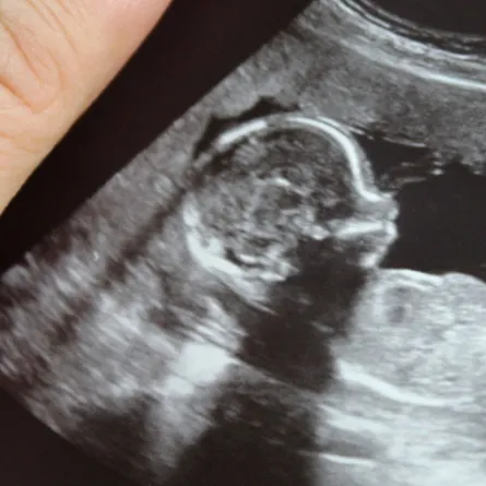 صورة للجنين