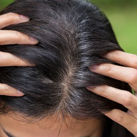 فوائد الشمندر للشعر الأبيض