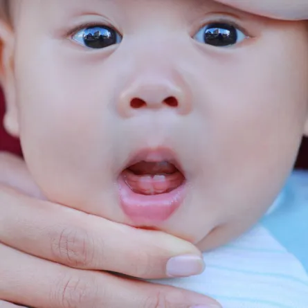 صورة لأسنان الرضيع