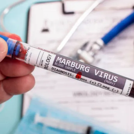 الإمارات تدعو مواطنيها لتجنب السفر إلى تنزانيا وغينيا الاستوائية