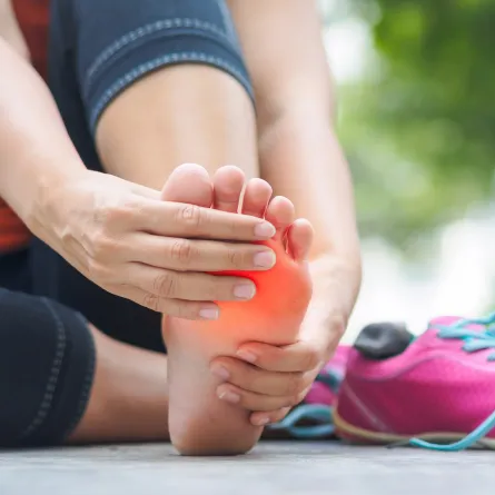 أسباب ظهور عين السمكة في القدم وعلاجها (المصدر: Adobe.Stock)