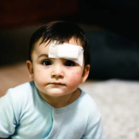 صورة لطفل وقع على رأسه