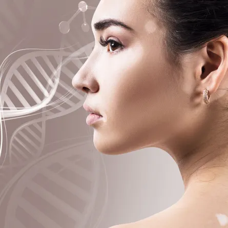 علاج البهاق