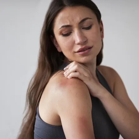 علاقة الحساسية بالحالة النفسية وطيدة..اكتشفيها لإدارة أعراضكِ (المصدر: Freepik)