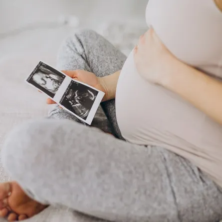 صورة لامراة حامل