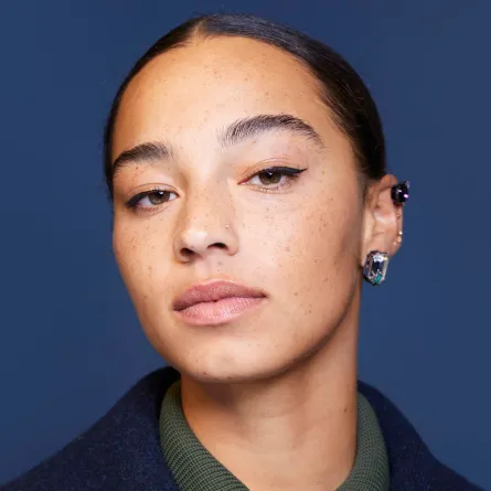 كيف نحتضن بشرتنا ونتقبلها؟ Embrace your Flaws