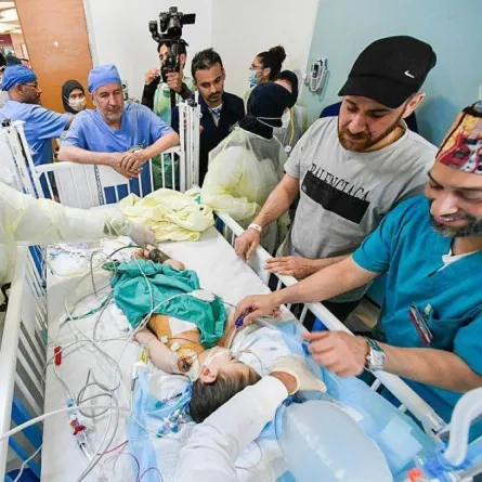 استقرار حالة السيامي السوري "بسام" الصحية