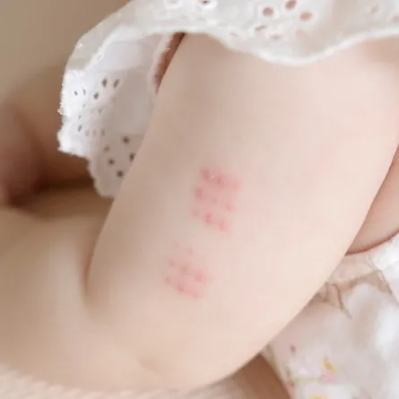 صورة لتطعيم الطفل