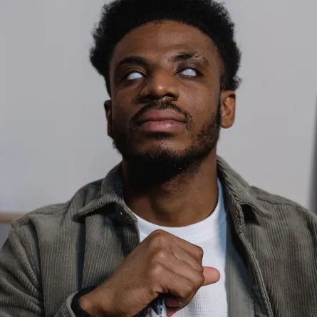 نيجيري يفقد بصره 