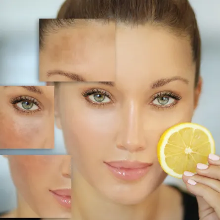 أفضل خلطات طبيعية لتبييض الوجه