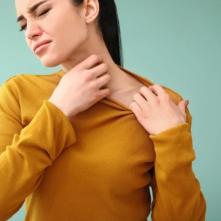 صورة لحامل تعاني من الطفح الجلدي