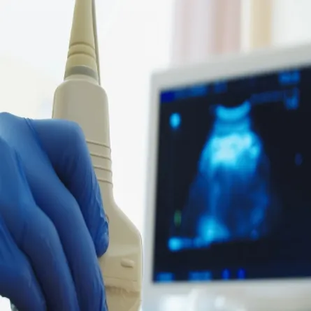 صورة لطبيب يجري أشعة سونار لامراة حامل