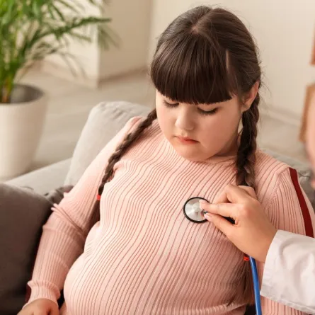 صورة لطفلة تعاني من السمنة