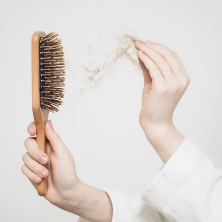 صورة لفتاة تعاني من سقوط الشعر