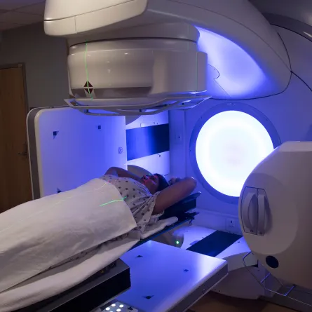 الآثار الجانبية للعلاج الإشعاعي لسرطان الثدي (المصدر: Shutterstock)