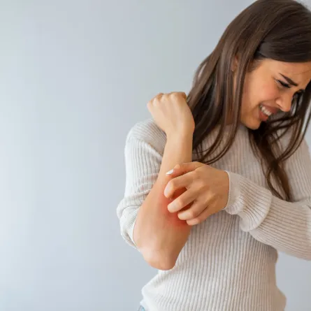 أسباب وطرق علاج الحكة النفسية (المصدر: Adobe.Stock)