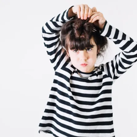 صورة لإصابة في الرأس