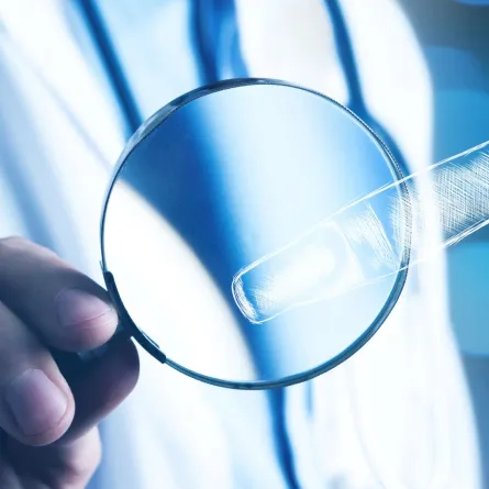 صورة لاختبار الحمل