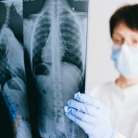 أعراض جلطة الرئة