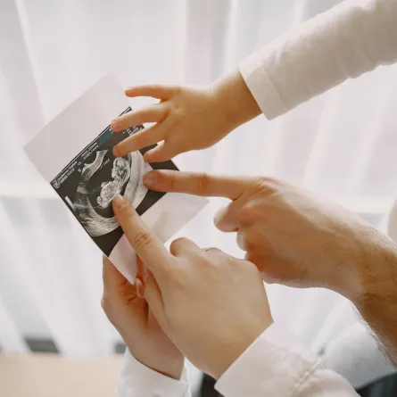 صورة للجنين